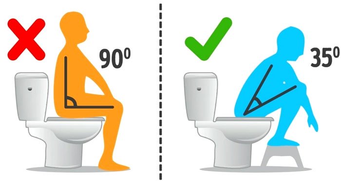 Nguy hiểm khi đi vệ sinh không đúng cách